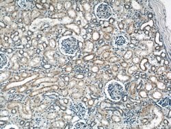 ACTO9 Rabbit anti-Human, Mouse, Rat, Polyclonal, Proteintech 150 &mu;L;
