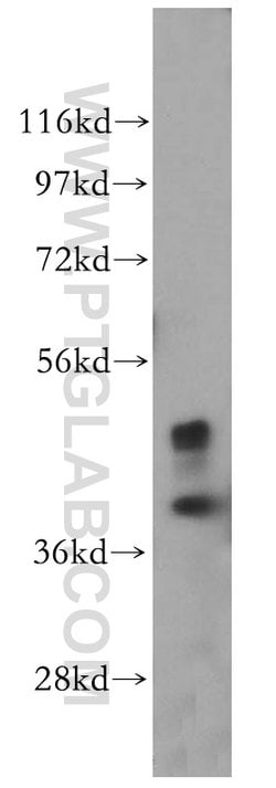 ACTO9 Rabbit anti-Human, Mouse, Rat, Polyclonal, Proteintech 150 &mu;L;