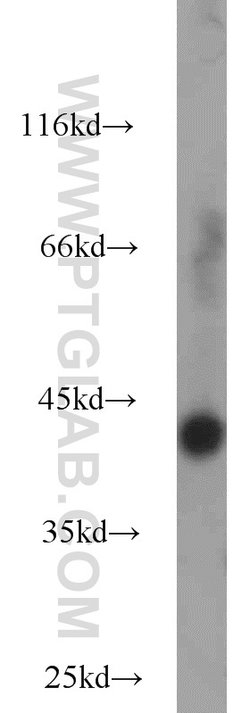 IDH3A Rabbit anti-Human, Mouse, Rat, Polyclonal, Proteintech 150 &mu;L;