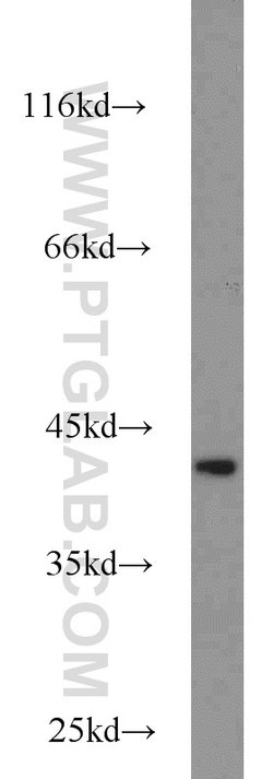 IDH3A Rabbit anti-Human, Mouse, Rat, Polyclonal, Proteintech 150 &mu;L;