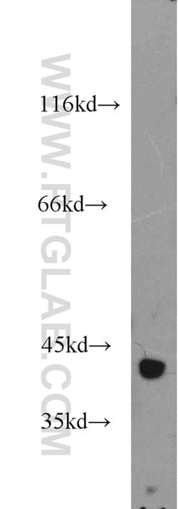 IDH3A Rabbit anti-Human, Mouse, Rat, Polyclonal, Proteintech 150 &mu;L;