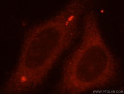 TBCC Rabbit anti-Human, Mouse, Rat, Polyclonal, Proteintech 150 &mu;L;