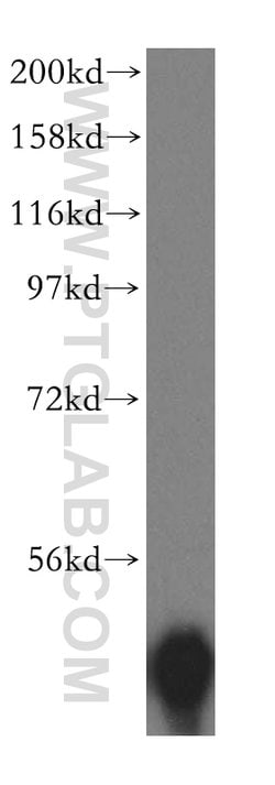TBCC Rabbit anti-Human, Mouse, Rat, Polyclonal, Proteintech 150 &mu;L;