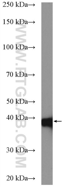 TBCC Rabbit anti-Human, Mouse, Rat, Polyclonal, Proteintech 150 &mu;L;