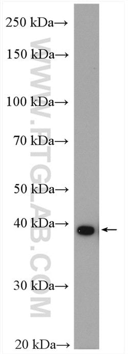 TBCC Rabbit anti-Human, Mouse, Rat, Polyclonal, Proteintech 150 &mu;L;