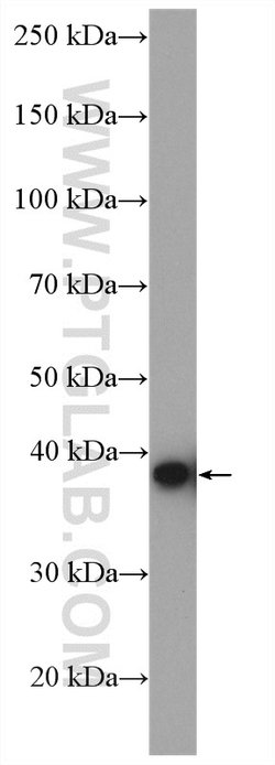 TBCC Rabbit anti-Human, Mouse, Rat, Polyclonal, Proteintech 150 &mu;L;