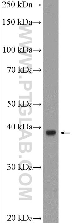 TBCC Rabbit anti-Human, Mouse, Rat, Polyclonal, Proteintech 150 &mu;L;