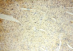 POLR1C Rabbit anti-Human, Mouse, Rat, Polyclonal, Proteintech 150 &mu;L;