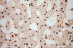 POLR1C Rabbit anti-Human, Mouse, Rat, Polyclonal, Proteintech 150 &mu;L;