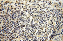 POLR1C Rabbit anti-Human, Mouse, Rat, Polyclonal, Proteintech 150 &mu;L;