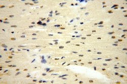 POLR1C Rabbit anti-Human, Mouse, Rat, Polyclonal, Proteintech 150 &mu;L;