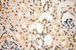 POLR1C Rabbit anti-Human, Mouse, Rat, Polyclonal, Proteintech 150 &mu;L;