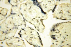 POLR1C Rabbit anti-Human, Mouse, Rat, Polyclonal, Proteintech 150 &mu;L;