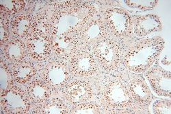 POLR1C Rabbit anti-Human, Mouse, Rat, Polyclonal, Proteintech 150 &mu;L;