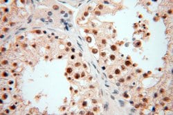 POLR1C Rabbit anti-Human, Mouse, Rat, Polyclonal, Proteintech 150 &mu;L;