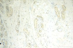POLR1C Rabbit anti-Human, Mouse, Rat, Polyclonal, Proteintech 150 &mu;L;
