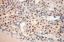 POLR1C Rabbit anti-Human, Mouse, Rat, Polyclonal, Proteintech 150 &mu;L;