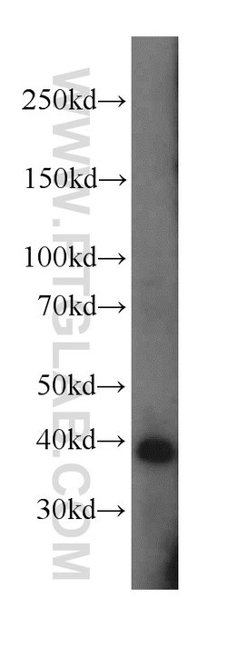 POLR1C Rabbit anti-Human, Mouse, Rat, Polyclonal, Proteintech 150 &mu;L;