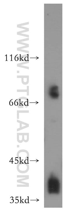 POLR1C Rabbit anti-Human, Mouse, Rat, Polyclonal, Proteintech 150 &mu;L;