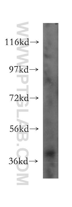 POLR1C Rabbit anti-Human, Mouse, Rat, Polyclonal, Proteintech 150 &mu;L;