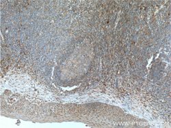 ValRS Rabbit anti-Human, Mouse, Rat, Polyclonal, Proteintech:Antibodies:Primary