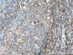 ValRS Rabbit anti-Human, Mouse, Rat, Polyclonal, Proteintech:Antibodies:Primary