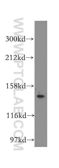 ValRS Rabbit anti-Human, Mouse, Rat, Polyclonal, Proteintech:Antibodies:Primary