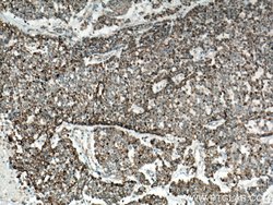 IDH2 Rabbit anti-Human, Mouse, Rat, Polyclonal, Proteintech 150 &mu;L;