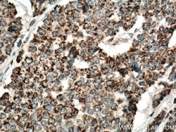 IDH2 Rabbit anti-Human, Mouse, Rat, Polyclonal, Proteintech 150 &mu;L;