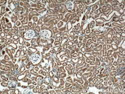 IDH2 Rabbit anti-Human, Mouse, Rat, Polyclonal, Proteintech 150 &mu;L;