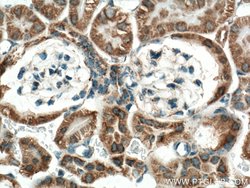 IDH2 Rabbit anti-Human, Mouse, Rat, Polyclonal, Proteintech 150 &mu;L;