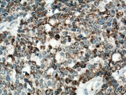IDH2 Rabbit anti-Human, Mouse, Rat, Polyclonal, Proteintech 150 &mu;L;