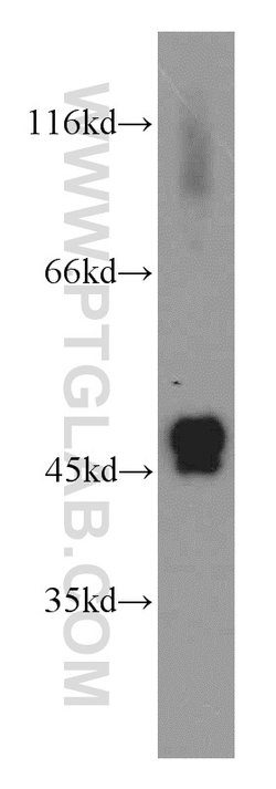 IDH2 Rabbit anti-Human, Mouse, Rat, Polyclonal, Proteintech 150 &mu;L;