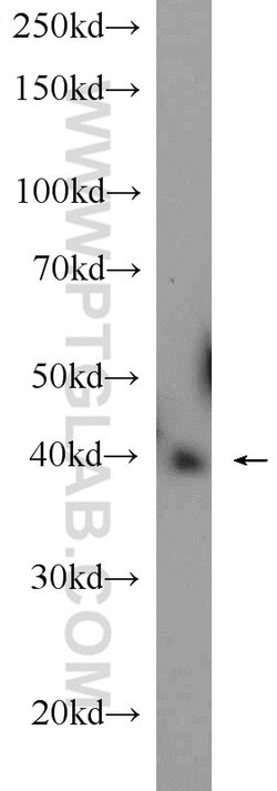 IDH2 Rabbit anti-Human, Mouse, Rat, Polyclonal, Proteintech 150 &mu;L;