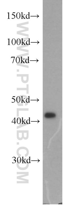 IDH2 Rabbit anti-Human, Mouse, Rat, Polyclonal, Proteintech 150 &mu;L;