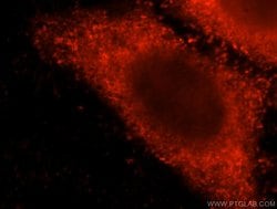CNOT10 Rabbit anti-Human, Mouse, Polyclonal, Proteintech:Antibodies:Primary