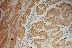 CNOT10 Rabbit anti-Human, Mouse, Polyclonal, Proteintech:Antibodies:Primary