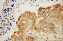 CNOT10 Rabbit anti-Human, Mouse, Polyclonal, Proteintech:Antibodies:Primary