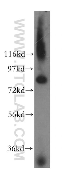 CNOT10 Rabbit anti-Human, Mouse, Polyclonal, Proteintech:Antibodies:Primary