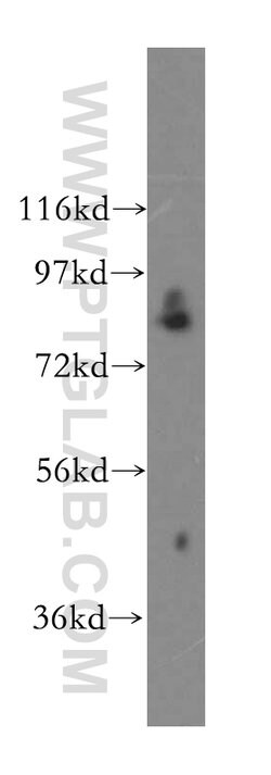 CNOT10 Rabbit anti-Human, Mouse, Polyclonal, Proteintech:Antibodies:Primary