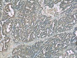 TIPE2 Rabbit anti-Human, Mouse, Rat, Polyclonal, Proteintech 150 &mu;L;