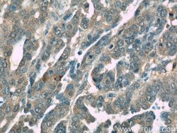 TIPE2 Rabbit anti-Human, Mouse, Rat, Polyclonal, Proteintech 150 &mu;L;