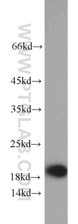 TIPE2 Rabbit anti-Human, Mouse, Rat, Polyclonal, Proteintech 150 &mu;L;