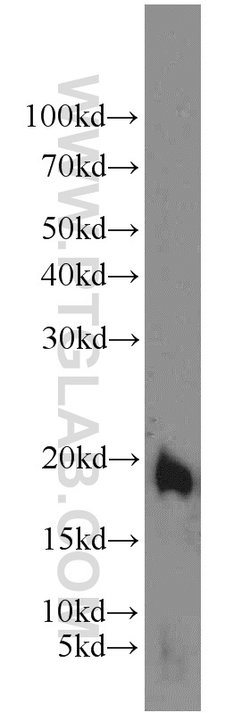 TIPE2 Rabbit anti-Human, Mouse, Rat, Polyclonal, Proteintech 150 &mu;L;