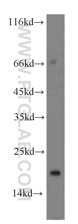 TIPE2 Rabbit anti-Human, Mouse, Rat, Polyclonal, Proteintech 150 &mu;L;