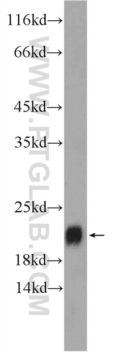 TIPE2 Rabbit anti-Human, Mouse, Rat, Polyclonal, Proteintech 150 &mu;L;