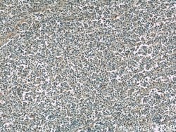 TIPE2 Rabbit anti-Human, Mouse, Rat, Polyclonal, Proteintech 150 &mu;L;