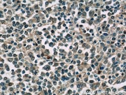TIPE2 Rabbit anti-Human, Mouse, Rat, Polyclonal, Proteintech 150 &mu;L;