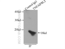 TIPE2 Rabbit anti-Human, Mouse, Rat, Polyclonal, Proteintech 150 &mu;L;