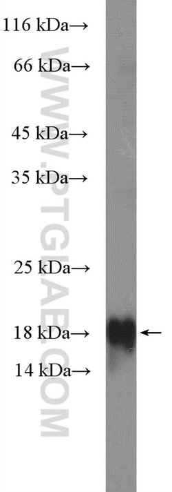 TIPE2 Rabbit anti-Human, Mouse, Rat, Polyclonal, Proteintech 150 &mu;L;